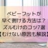 ベビーフットが早く剥ける方法は？ズルむけのコツ7選【むけない原因も解説】
